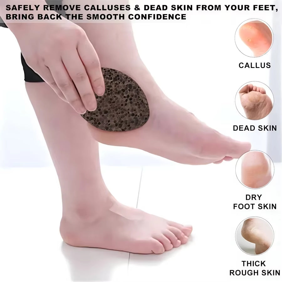 Natural Pumice Stone – Smooth Away Calluses on Feet