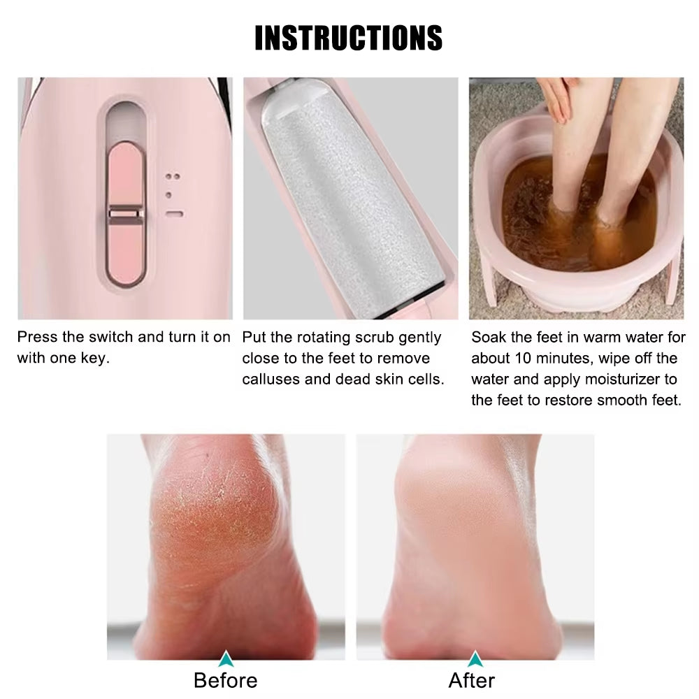 Electric Foot Scraper – Bye Bye Dead Skin